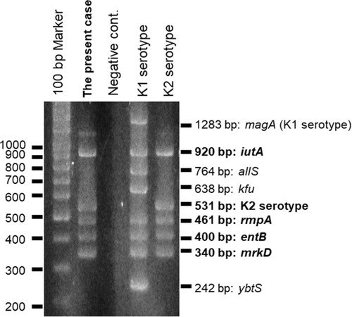 Figure 3 Multiplex PCR. The isolated strain possessed iutA, rmpA, entB, and mrkD.