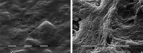 Figure 3. The concavities of the porous hypomineralized enamel embedded bacterial colonies. ×1500 and ×3000.