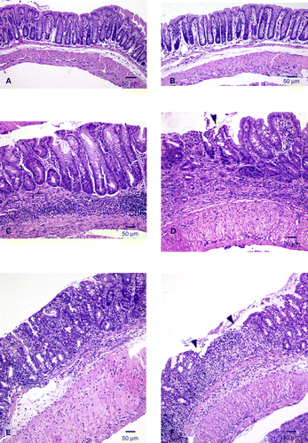 Figure 5 Representative haematoxylin and eosin-stained tissue sections from the different experimental groups. (A) Water–sham–water. (B) Water–WAS–water. (C) 3% DSS–sham–water. (D) 3% DSS–WAS–water. (E) 3% DSS–sham–1% DSS. (F) 3% DSS–WAS–1% DSS. The arrowheads in D and F denote areas of epithelial damage. Scale bar: 50 μm.