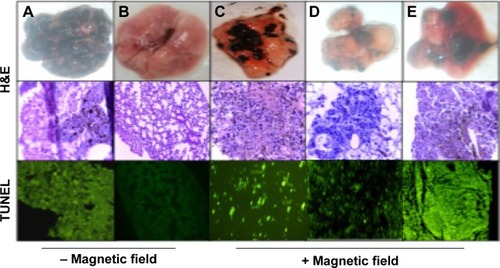 Figure 6 Images of lungs excised from melanoma-bearing mice after different treatments, and H&E and TUNEL-assay tissue sections from excised lungs.Notes: (A) PBS; (B) normal; (C) naked plasmid; (D) plasmid/DogtorMag/magnetic nanoparticles; (E) plasmid/chitosan/magnetic nanoparticles. Magnification for H&E: (A) 40×, (B) 10×, (C) 40×, (D) 40×, (E) 40×; TUNEL: (A) 40× (B) 10× (C) 40× (D) 40×, (E)10×.Abbreviations: H&E, hematoxylin and eosin; TUNEL, terminal deoxynucleotidyl transferase deoxyuridine triphosphate nick-end labeling; PBS, phosphate-buffered saline.
