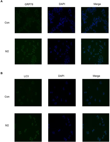 Figure 5 Melatonin activated autophagy by ER stress in GC cells (A, B) AGS cells were immunostained with GRP78 and LC3 antibodies and observed by the microscope (magnification, x400). Data are shown as means ± SEM of at least 3 independent experiments.