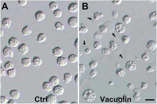 Figure 1. Induction of enucleation in MEL cells with Vacuolin-1 stimulates MEL cells to enucleate. (A) MEL cells were grown continuously in culture without any treatment. The cells are relatively uniform, with no spontaneous enucleation. (B) MEL cells were treated with Vacuolin-1 for 48 hrs to induce enucleation. Arrows point to enucleating cells. The larger, homogenous looking cells will become reticulocytes, and the smaller cells that appear to be budding off are the pyrenocytes that contain the extruded nuclei. Arrows, enucleating cells. Bar = 10 µm