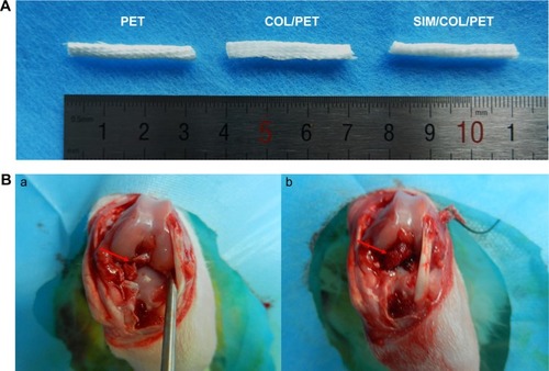 Figure 2 Digital images of the grafts and ACL reconstruction operation.Notes: (A) Gross observation of PET, COL/PET, and SIM/COL/PET scaffolds. (B, a) Macroscopic view of rabbit knee joint (the arrow points to ACL rupture). (B, b) Macroscopic view of ACL reconstruction (the arrow points to implant).Abbreviations: PET, polyethylene terephthalate; COL/PET, collagen coating on polyethylene terephthalate scaffolds; SIM/COL/PET, collagen and simvastatin microspheres coating on polyethylene terephthalate scaffolds; ACL, anterior cruciate ligament.