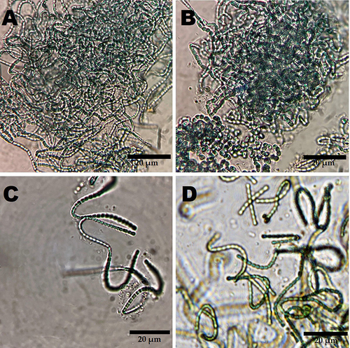 Figure 1 Light (A-C) and inverted light (D) micrographs illustrating the barrel-like filaments of N. muscorum Lukesova 2/91. Scale bar = 20 µm.