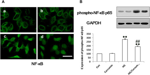 Figure 4 Influence of Curcumin on expression of NF-κB in NRK-52E cells. (A) The NRK-52E cells were pre-treated with Curcumin (20 μM) for 24 h. Following Curcumin treatment, the medium was changed and cells were treated with 30 mM HG for 48 h. The NF-κB protein was stained and observed under a fluorescence microscope as described in Materials and Methods. a. control group; b. Curcumin group; c. HG group; d. HG/Curcumin group (magnification was ×400, Scale bars=30 μm). (B) The protein expression of phospho-NF-κB p65 was detected by Western blotting, relative expression levels of phospho-NF-κB p65 was determined by densitometry and normalized by GAPDH, and data are represented as percentages of the control group. (**P < 0.001 vs Control group, ##P < 0.001 vs HG).
