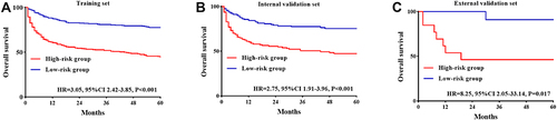 Figure 5 Kaplan–Meier curves of the high-risk and low-risk group of PsI-DLBCL patients stratified by the survival nomogram predicted probabilities in training set (A). internal validation set (B) and external validation set (C).