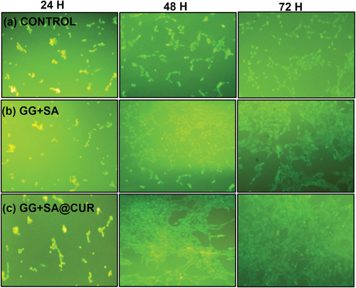 Figure 9. Fluorescence microscope images of cell viability for the (a) TCPP control sample (b) GG+SA and (c) GG+SA@CUR thin film cultured in the medium containing fibroblast cells for 24 h, 48 h and 72 h.