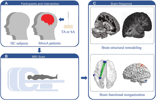Figure 1 Trial profile. (A) Participants and intervention. (B) MRI scan. (C) Brain response.