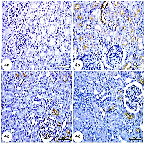 Figure 4. Photomicrographs from immunohistochemistry of kidney section of rats showing (a): negative immunoreaction for COX-2 in kidney cortex. (b): Group CCl4 showing strong immune expression for COX-2 in renal tubule cells, (c): CCl4 + rats BM-MSCs of kidney cortex collecting and (d): CCl4 + mice BM-MSCs showing weak immunoreaction for COX-2 in collecting tubule cells of kidney cortex. (Immunostaning for COX-2; Scale bar of a–d = 50 µm).