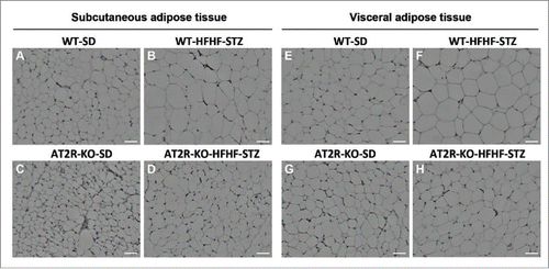 Figure 4. H&E staining of adipose tissue from WT and AT2R-KO mice, after 6 weeks fed a standard diet (SD) or high-fat/high-fructose diet with STZ (HFHF-STZ). Sections (5 μm) of subcutaneous (A-D) and visceral (retroperitoneal) adipose tissues (E-H) were stained with H&E. Ten images per histological section were used for analysis. Images were acquired using a Leica microscope equipped with a 10X objective. Scale bar, 40 μm.