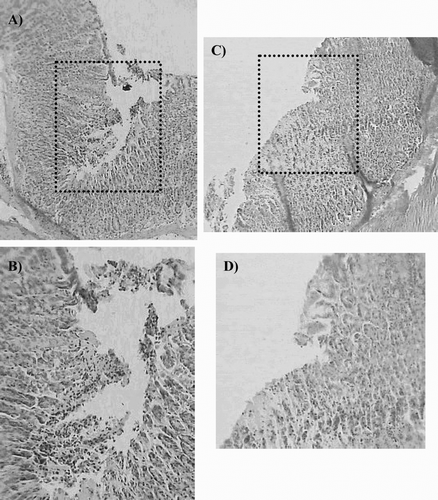 Figure 2.  Microscopic study (H/E section) of gastric mucosa of animals pretreated with dry residue from ethanol extract of P. carpunya before ulcer induction with diclofenac. (A and B), gastric lesion after diclofenac administration; (C and D), gastric mucosa of rats treated with P. carpunya (250 mg/kg) before diclofenac administration. Original magnification × 100 and × 200 respectively.