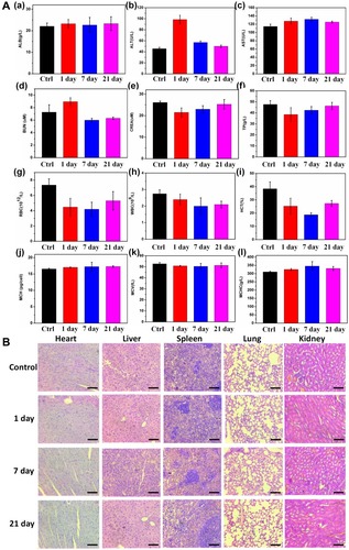 Figure 8 In vivo toxicity test of Mn-MoS2 QDs: (Aa–l) Mouse serum biochemistry analysis and blood routine analysis before (0d, control) and after injection of Mn-MoS2 QDs for 1, 7, 21d. (B) Histological images of the heart, lungs, liver, spleen and kidneys of mice 1, 7 and 21 days post-intravenous injection of Mn-MoS2 QDs and in control mice. The organs were sectioned and stained with hematoxylin and eosin (H&E) and observed under a light microscope, scale bar = 100 μm.