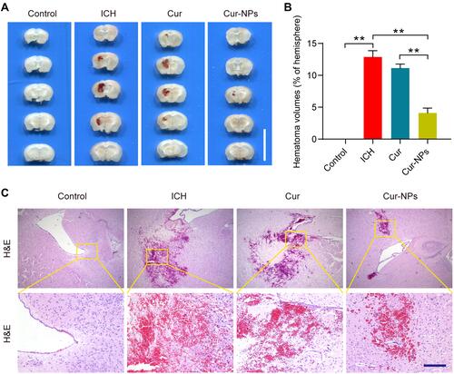 Figure 6 Cur-NPs treatment is associated with a reduction in the hematoma volume in the murine brain. (A) Hematoma images in brain tissue sections from ICH model mice. Scale bar: 10 mm. (B) The percentage of hematoma volume for ICH model mice in the indicated groups (means ± SD, n = 6). (C) H&E stained brain tissues sections from the indicated groups. **Indicates P < 0.01.