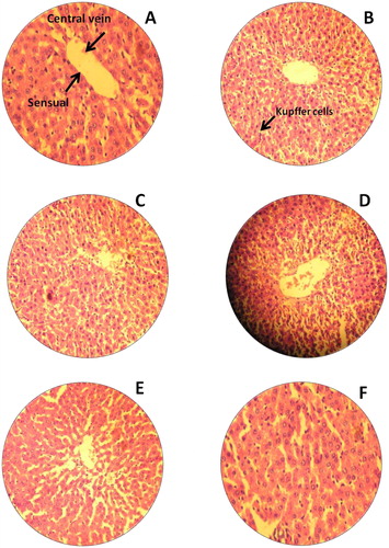 Figure 5. H&E staining of rat liver. (A) Untreated rat for 14th day (−); (B) Untreated rat for 28th day, normal liver tissues central vein and sensual (−); (C) Rats treated with Bio-AgNPs, i/p route for 14th day (+); (D) Rats treated with Bio-AgNPs, i/p route for 28th day(−); (E) Rats treated with Bio-AgNPs, i/v route 14th day (+); (F) Rats treated with Bio-AgNPs, i/v route for 28th day (−). *where (−) indicates no changes, (+) indicates mild changes, (++) indicates moderate changes, (+++) indicates severe changes.