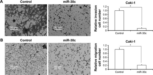Figure 5 miR-30c inhibits in vitro invasion and migration of Caki-1 cells.