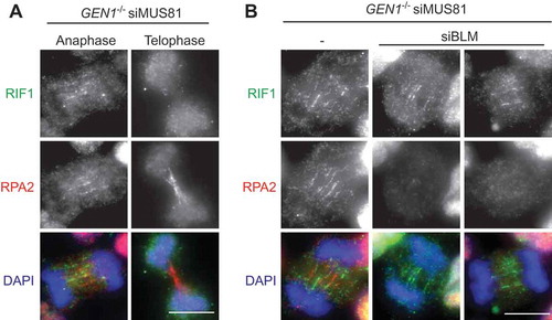 Figure 3. Localisation of RIF1 on double-stranded HR-UFBs.(a) GEN1–/– 293 cells generated by CRISPR-Cas9 editing were treated with siRNA against MUS81. 24 hours after siRNA transfection, the cells were treated with cisplatin (1 μM for 1 h and released into fresh media for 24 h). RPA2, RIF1 and DNA were visualized using anti-RPA2 antibody (red), anti-RIF1 antibody (green), and DAPI (blue) as indicated. Examples of anaphase and telophase cells are shown. (b) GEN1–/– 293 cells were treated with siRNA against MUS81 alone or together with siRNA against BLM. 24 hours after siRNA transfection, the cells were treated with cisplatin (1 μM for 1 h and released into fresh media for 24 h). RPA2, RIF1 and DNA were visualized as indicated. Scale bars, 10 μm.