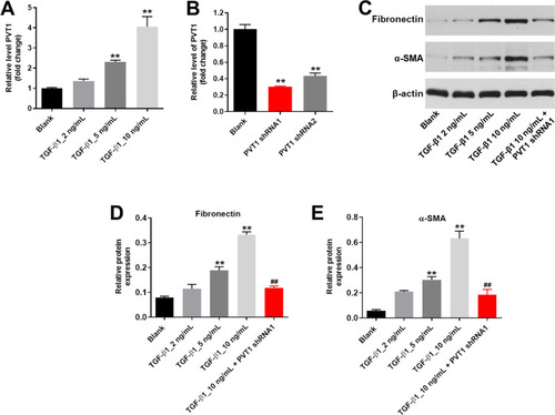 Figure 1 Silencing of PVT1 significantly inhibited the progression of renal fibrosis in vitro. (A) HK-2 cells were treated with 2, 5 or 10 ng/ml TGF–β1 for 48 h. Then, the expression of PVT1 in HK-2 cells was detected by qRT-PCR. (B) HK-2 cells were transfected with PVT1 shRNA1 or shRNA2 for 24 h. Then, the expression of PVT1 in HK-2 cells was detected by qRT-PCR. (C) The protein expressions of Fibronectin and α-SMA in HK-2 cells were measured by western blot. (D) The relative protein expression of Fibronectin was quantified by normalizing to β-actin. (E) The relative protein expression of α-SMA was quantified by normalizing to β-actin. **P < 0.01 compared to Blank, ##P < 0.01 compared to 10 ng/ml TGF-β1.