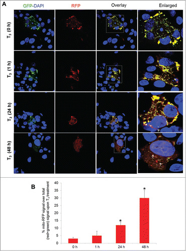 Figure 4. T3 increases mitophagic flux time dependently in hepatic cells. (A) THRB-HepG2 cells transiently expressing Mito-mRFP-EGFP were treated with 100 nM T3 for different time periods followed by visualization using confocal microscopy (40X magnification). Nuclei were stained with DAPI (blue). In the images, fluorescence signals indicate the expression of Mito-mRFP-EGFP targeting mitochondria: yellow color, no mitophagy or normal mitochondria; red color, mitophagy or mitochondria inside lysosomes. (B) Quantitative analysis of the RFP (red) fluorescence to denote % mitophagy. Quantification of images (at least 10 transfected cells per each sample in 3 different fields) was conducted with ImageJ software. Bars represent the mean of the respective individual ratios ±SD (*, P < 0 .05).