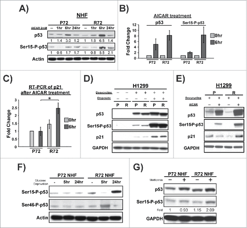 Figure 2. AMPK activation induces p53 with distinct kinetics in cells that differ in the codon 72 polymorphism. (A) P72 and R72 NHF were treated with AICAR (2 mM) for 1, 6, or 24 hr. Expression levels of p53 and serine-15 phosphorylated p53 were detected by western blot analysis. Actin is included as the loading control. (B) Levels of p53 and serine-15 phosphorylated p53 were quantified after 6 hours of AICAR treatment. Error bars represent standard error. The values depicted are the average quantification from 2 independent experiments. (C) qRT-PCR assessment of the mRNA level of the p53 target gene CDKN1A (p21) in NHF cells treated with AICAR for 6 hr. The data represent the average from 3 independent experiments, error bars mark standard error. The asterisk denotes p-value <0.05. (D) Human lung cancer cell line H1299 expressing doxycycline-inducible P72 or R72 versions of p53 were treated with doxycycline plus etoposide. Expression levels of p53, serine-15 phosphorylated p53 and CDKN1A (p21) were detected by western blot analysis. GAPDH is the loading control. (E) Human lung cancer cell line H1299 expressing doxycycline-inducible P72 or R72 versions of p53 were treated with doxycycline plus AICAR, as indicated in the figure. Expression levels of p53, serine-15 phosphorylated p53 and CDKN1A (p21) were detected by western blot analysis. GAPDH is the loading control. (F) P72 and R72 NHFs were deprived of glucose for 0, 5, or 24 hr and probed by western blotting for the proteins indicated. The results depicted are representative of 3 independent experiments. (G) P72 and R72 NHFs were treated with Metformin (5 mM) for 6 hr. Western blot analyses were performed using antisera against the proteins indicated. The results depicted are representative of 2 independent experiments; densitometry results are normalized to GAPDH control.