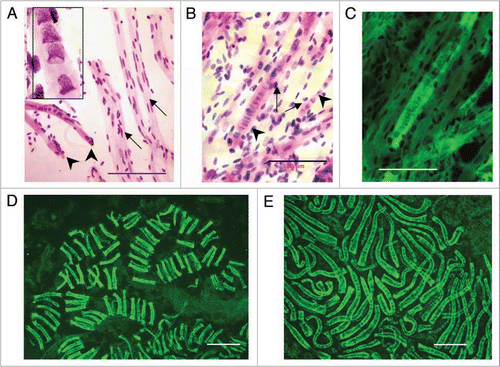 Figure 3 Syncytial clusters in different human fetal meta-organs. (A) Cardiac unstriated muscle at 10 weeks: Feulgen purple stained tubular syncytia (left low corner, arrows) with bell shaped nuclei in central position (zoomed image, left upper corner, 100x). Tubular syncytia are striated with bell shaped nuclei and thus distinct from differentiated cardiac unstriated muscle fibers (arrows) with closed elliptical nuclei aligned with surface of muscle fiber. (B) Skeletal striated muscle of thigh at 10 weeks: Feulgen purple stained tubular syncytia (arrows) lying in parallel with striated muscle fibers (arrowed) with sarcomeric structures with closed elliptical nuclei apparently externally associated to muscle fibers. (C) Same image as (B) merged with green Feulgen fluorescent image. Fluorescence from metakaryotic tubular syncytia is more intense than from differentiated muscle fibers. (D) Spinal cord ganglia at 9 weeks. Multiple clusters of tubular syncytia with 16 bell shaped nuclei each, green Feulgen fluorescence superimposed on purple stained Feulgen image. (E) Brain at 9 weeks. Clusters of syncytia with ∼16–32 bell shaped nuclei each stained as in (C and D). Scale bar, 100 µm.
