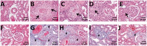 Figure 3. The effect of ethanol extract of L. paracasei subsp. paracasei NTU 101-fermented products on kidney structure in rats with hypertension-induced vascular dementia. (A–E) Hematoxylin-eosin-stained sections of the kidneys from rats treated with saline (A), DOCA-salt (B), NTU101F 0.5 (c), NTU101F 1.0 (D), and NTU101F 5.0 (E). (F–J) Masson’s trichrome-stained sections demonstrating collagen deposition (blue) in the kidneys from control (F), DOCA-salt (g), NTU101F 0.5 (H), NTU101F 1.0 (I), and NTU101F 5.0 (J) rats. Arrows and # mark inflammation and fibrosis, respectively (magnification, ×400). The meaning of abbreviations was shown in Figure. 1.