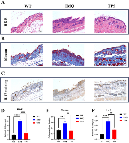 Figure 2 TP5 alleviated the pathological features of psoriatic skin and reduced collagen infiltration and IL17 expression in the epidermis of psoriatic mice. (A) Representative images of H&E staining (scale bar = 50 μm). (B) Masson staining (scale bar = 50 μm). (C) IL-17 immunohistochemical staining (scale bar = 50 μm) of skin sections from mice in the WT, IMQ, and TP5 groups. (D–F) Statistical plots of epidermal layer thickness, the proportion of skin collagen, and the proportion of IL-17-positive skin sections from mice in the WT group, IMQ group, and TP5 group, as determined by H&E, Masson, and IHC staining. The scores are expressed as the mean ± standard deviation. **P < 0.01, ***P < 0.001, ****P < 0.0001, ##P < 0.01, ####P < 0.0001; TP5 group vs IMQ group.