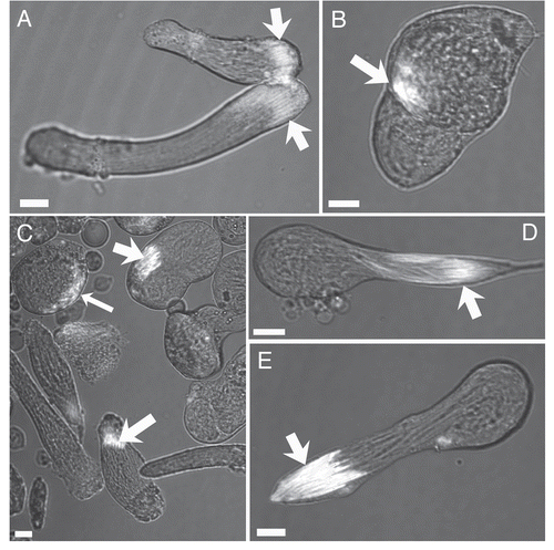 Figure 9 Brightfield images of cultured cysts with fluorescence signal from nuclei (arrows) overlaid. (A) Examples of normal elongating cysts after 24 hours in GSH-treated culture. (B–E) abnormal cysts present after 72 hours in BSO-treated cultures. Several different types of abnormally elongating cysts were observed. In some cases, the nuclei appeared to begin elongation, but became disorganized (large arrows, B and C), while the elongation of the tail portion of the cysts was retarded. Some cysts at the pre-elongation, round spermatid stage also exhibited disorganized nuclei (small arrow, C). (D and E) show cysts with normally elongating nuclei (arrows), but abnormally developed tail regions of the cysts.