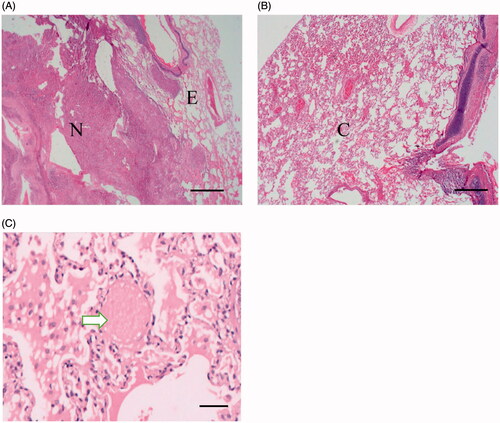 Figure 2. Pathological examination of the ablated area and the peripheral lung tissue. (A) After hematoxylin and eosin staining (HE staining), the ablated area demonstrated three layers, including the central necrotic area (tagged with N, scale bar = 500 μm), the intermediate area (tagged with E) and the outermost layer (tagged with C), shown in B (scale bar = 500 μm). (C) At the outermost area, ghost red blood cells caused by thermal injury were observed (white arrow, HE staining, scale bar = 100 μm).