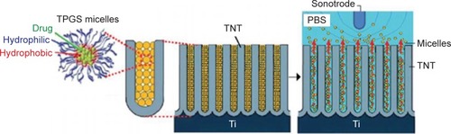 Figure 9 Schematic illustration of ultrasound-stimulated DD based on TNT implants and polymeric micelles as drug carriers. Reprinted from Int J Pharm, 443, Aw MS, Losic D, Ultrasound enhanced release of therapeutics from drug-releasing implants based on titania nanotube arrays, 154–162,Citation97 Copyright (2013), with permission from Elsevier.Abbreviations: DD, drug delivery; PBS, phosphate-buffered saline; TNT, titania nanotube.