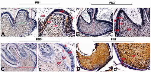 Figure 1. Immunohistochemical staining of VPS4B in postnatal mouse tooth germs. The tissue sections were counterstained with hematoxylin. (A-a) At the late bell stage (PN1), VPS4B was strongly expressed in the DP and SI and expressed less strongly in OD near the DP. (B-b) On PN2, VPS4B was expressed in both the DP and SI. (C-c) On PN5, VPS4B was consistently expressed in the DP and SI, with minimal expression in OD. (D-d) On PN7, VPS4B was highly expressed in the DP and OD. AM: ameloblasts; D: dentin; DP: dental pulp; OD: odontoblasts; POD: preodontoblasts; SR: stellate reticulum; SI: stratum intermedium.