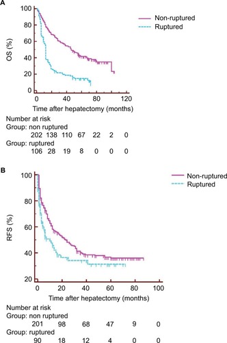Figure 2 (A) OS and (B) RFS after hepatectomy for ruptured and non-ruptured HCC.