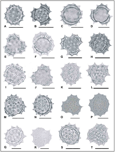 Figure 5. Light micrographs of pollen grains (×1000) Achillea gypsicola (A, B) (from Arabacı 2221), (C, D) (from Arabacı 2224), (E, F) (from Arabacı 2208); Achillea boissieri (G, H) (from Arabacı 1963); Achillea aleppica subsp. aleppica (I, J) (from Arabacı 1383), (K, L) (from Yıldız 1513), (M, N) (from Arabacı 1388), (O, P) (from Arabacı 2174); Achillea aleppica subsp. zederbaueri (Q, R) (from Arabacı 1594); Achillea pseudoaleppica (S, T) (from Arabacı 1441). Scale bars 20 μm.