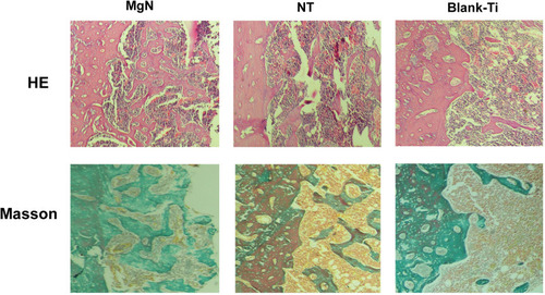 Figure 8 H&E staining and Masson’s trichrome staining evaluation of the effects of MgN, NT and blank-Ti on bone regeneration.Notes: Four weeks after implantation, cubic and short pre-osteoblasts were lined surrounding the trabecular bone and MgN implants. On the same day, newly generated small vessels were scattered in trabecular bone. Angiogenesis and osteogenesis were intricately modulated in the formation of bone tissues. The MgN group showed robust new formation of bone tissues, which delimited the defected area with the implantation of MgN implant. The defected area filled by the blank Ti and NT groups showed less bone area than that of MgN group, indicating that MgN could enhance the formation of bone tissues compared with the NT and blank-Ti groups.Abbreviation: H&E staining, hematoxylin and eosin staining.