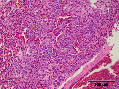 Figure 4.  Pulmonary histopathology of a juvenile brown kiwi illustrating coccidial meronts (H&E stain). Scale bar = 100 µm.