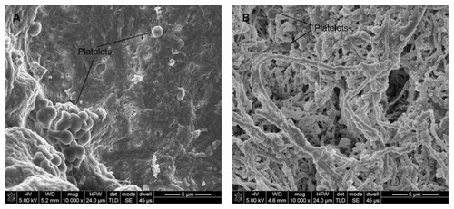 Figure 7 SEM images (5000×) of platelets adhering to the surface of unmodified (A) and heparin/DHI-modified bovine jugular vein scaffolds (B).Note: The arrows indicate adhering platelets.Abbreviations: DHI, dihydroxy-iron; SEM, scanning electron microscope.