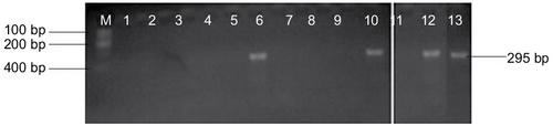Figure 3 blaTEM genes recovered from ESBL type isolates on agarose gel.