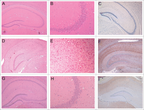 Figure 5. Histopathology and PrP-immunohistochemistry of brain sections from hamsters challenged with inoculum 8 (hamster 8.1: 151 dpi). Hematoxylin and eosin (H&E)-stained samples (2 columns on the left) and PrP immunohistochemistry using anti-PrP-antibody SAF32 (right column). (A-C) Control hamster, (D-F) hamster challenged with inoculum 8.1 (terminal phase, 76 dpi), (G-I) hamster challenged with SAFs of 263K scrapie agent (terminal phase, 76 dpi). The brain of the hamster challenged with inoculum 8.1 showed intense tissue damage of the hippocampus, extensive spongiosis, severe gliosis and neuronal loss (D, E). PrPSc immuno-detection (F) displayed a diffuse and widespread distribution that has not previously been observed in hamsters challenged with 263K SAFs (I).