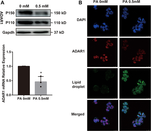 Figure 3 ADAR1 is downregulated in palmitic acid -treated HepG2.2.15 cells. (A) The mRNA and protein levels of ADAR1 in the control group and palmitic acid group. (B) After 24 h of palmitic acid treatment, cells were stained with antibody ADAR1 and fluorescent labeled Nile red, and then observed under a fluorescence microscope. (Scale bar: 25μm) *P < 0.05.