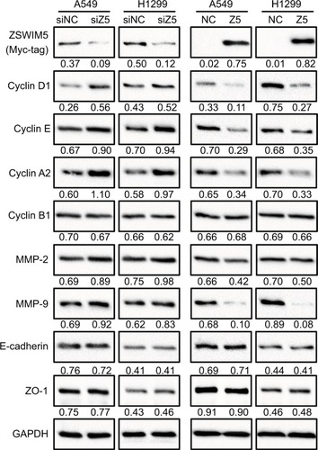 Figure 5 ZSWIM5 downregulates the expression of cyclins and MMPs.Notes: siRNA treatment of ZSWIM5 in A549 and H1299 cells upregulated the expressions of cyclin D1, cyclin E, cyclin A2, MMP2, and MMP9. In contrast, transfection A549 and H1299 cells with ZSWIM5 inhibited the expressions of cyclin D1, cyclin E, cyclin A2, MMP2, and MMP9. There was no obvious change in the expressions of cyclin B1, e-cadherin, and ZO-1 in A549 or H1299 cells.Abbreviation: ZSWIM5, zinc finger SWIM-type containing 5.