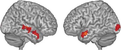 Figure 2. Whole-brain functional activation for the inhibition contrast (no-go > go trials). Results shown are cluster-level FDR-corrected. See Table 2 for significant clusters.