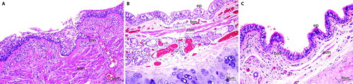 Figure 3.  Longitudinal sections of a large airway of patients with asthma (A), COPD (B) and a control patient (C). The basement membrane (bm) in A is thicker than in B and C, and has an hyaline eosinophilic aspect. Observe the thick airway smooth muscle (asm) bundle in A. Submucosal gland = sm, cartilage = c. H&E staining. Scale bar = 50 μm.