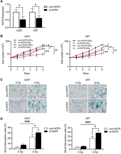 Figure 3 HCP5 knockdown increased radiosensitivity in human glioma cell lines. si-HCP5 was transfected into U87 and U251 cells. (A) The expression of HCP5 for 48h following si-HCP5 transfection. (B) The effect of HCP5 Knockdown on cell proliferation exposed following radiation. (C) Representative photographs for SA-β-Gal staining. (D) The effect of HCP5 Knockdown on cell senescence for 72h following radiation exposure. *p < 0.05, **p < 0.01, ##p < 0.01, ####p < 0.0001.