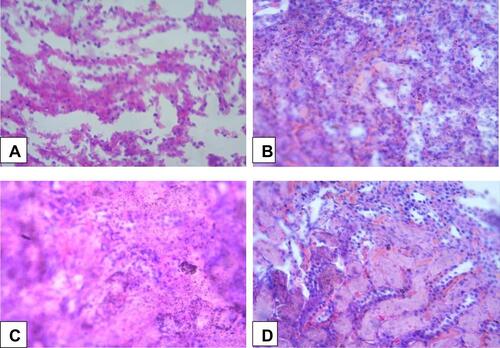 Figure 2 Histopathological changes in the kidney tissue treated with ethyl acetate fraction. (A) Normal control group (normal structures), (B) Cyclophosphamide control group (necrosis), (C) Ethyl acetate fraction 100 mg/kg (necrosis), (D) Ethyl acetate fraction 200 mg/kg (inflammatory cells and congestion).