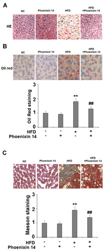 Figure 3 Administration of phoenixin 14 ameliorates hepatic tissue damage, lipid deposition, and fibrosis in HFD-fed mice. (A) Representative liver histological section images; (B) Representative images and quantitative graph of liver Oil Red staining for the four groups of mice; (C) Representative images and quantitative graph of Masson staining for the four groups of mice (**P<0.01 vs vehicle group; ##P<0.01 vs HFD group).