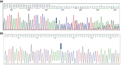 Figure 2. Sequence analysis - (a) BCOR–frameshift variant c.3621delA in affected member, (b) BCOR wild type in normal individual.