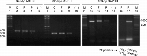 Figure 4. Integrity of RNA extracted from frozen versus paraffin‐embedded tissue. RNA extracted from (C) A549 cells, (F) frozen tissue, and (P) paraffin‐embedded tissue was analyzed by RT‐PCR using primer pairs specifying the 375‐bp actin, 296‐bp glyceraldehyde 3‐phosphate dehydrogenase (GAPDH) and 983‐bp GAPDH targets. Ethidium bromide‐stained gels of the 375‐bp actin (lanes 2–5), 296‐bp GAPDH (lanes 7–10) and 983‐bp GAPDH (lanes 12–15, 16, 17) products are shown and include the respective negative controls (−) where the cDNA was replaced by distilled water in the PCR reactions. cDNA was synthesized from equal amounts of RNA as template using oligo (dT)25 as the primer for reverse transcriptase except for lane 17 where random hexamers were used. (M) 100‐bp DNA ladders with bp sizes indicated at the left of the gel for the 375‐bp actin and 296‐bp GAPDH targets and at the right for the 983‐bp GAPDH target.