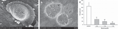 Figure 4. Scanning electron microscopy. A: The morphology of osteoclasts in the bone sections were clear, in fried-egg-shaped long strips; funnel or irregular shapes and large and flat tulle-like pseudopodias could be seen, with a large number of filamentous processes in the cell surface. B: The bone resorption pits were round or oval, which were rough on the bottom and clear in border. C: Bone resorption pits counting of bone sections (n = 10) by toluidine blue staining; under a ×100 inverted phase contrast microscope, the staining-positive pits in an entire bone section were counted. We found that, compared with the control group, the toluidine blue staining-positive resorption pit counting of the RANK groups decreased significantly, with a statistically significant difference (P<0.01).