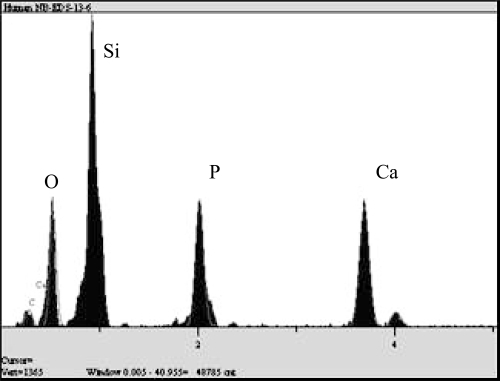 Figure 6 EDS analysis of CNP apatite. Si peak is because of the glass substrate on which CNP samples were cultured.Abbreviations: CNP, calcifying nanoparticles; EDS, energy dispersive spectroscopy.