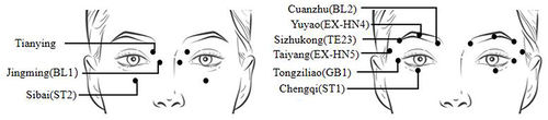 Figure 2 Schematic diagram of the acupressure point locations for eye exercises.