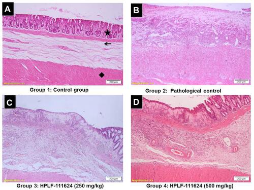 Figure 8 Representative photomicrographs showed the effect of HPLF-111624 on the histopathological changes of rectum tissues in acetic acid-induced ulcerative proctitis.